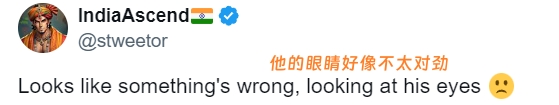 乔丹的眼白严重发黄网友担心他健康问题：黄疸检查肝脏吧！