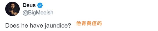 乔丹的眼白严重发黄网友担心他健康问题：黄疸检查肝脏吧！